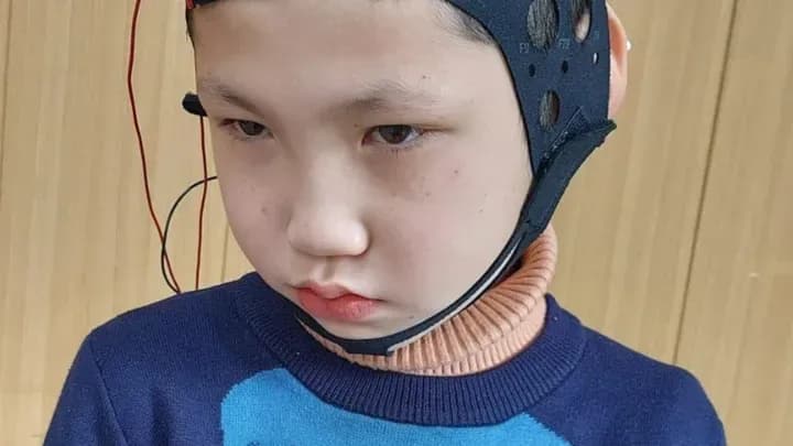 Help My Brother-In-Law Get Autism Treatment in Turkey